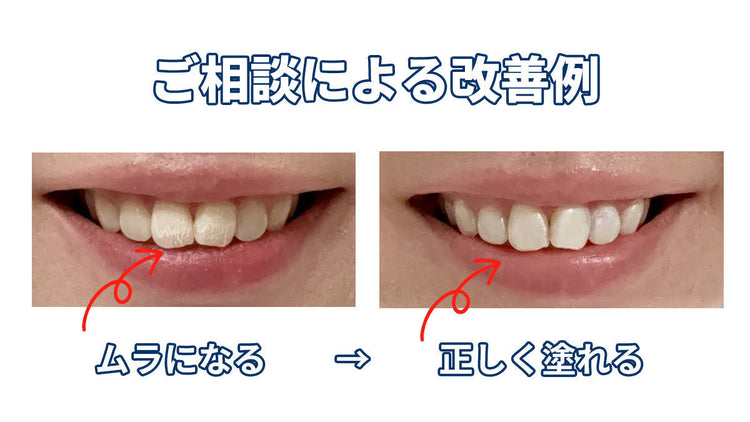 歯の化粧品の使い方を歯の化粧品アドバイザーにご相談いただけます