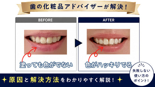 歯のマニキュアを塗っても色が出ない悩みについて、歯の化粧品アドバイザーが原因ときれいに発色させる方法を解説する画像