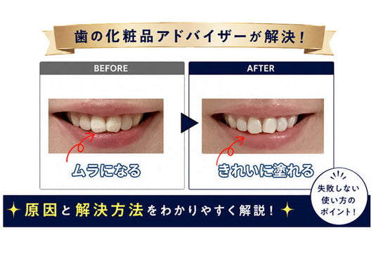 歯のマニキュアがムラになった失敗例ときれいに仕上がった例を比較し、歯の化粧品アドバイザーが原因と解決方法を紹介