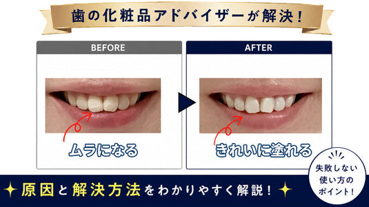 【コラム公開】歯のマニキュアがムラになる原因と解決方法