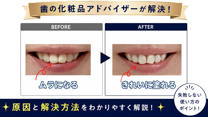 【コラム公開】歯のマニキュアがムラになる原因と解決方法