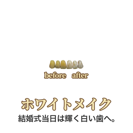 コスメティースB Bridal｜結婚式・前撮り専用の歯の化粧品