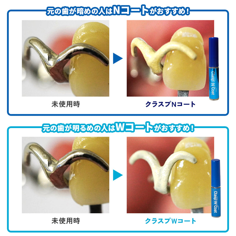 ギャラリービューアに画像をロードする, クラスプ コート
