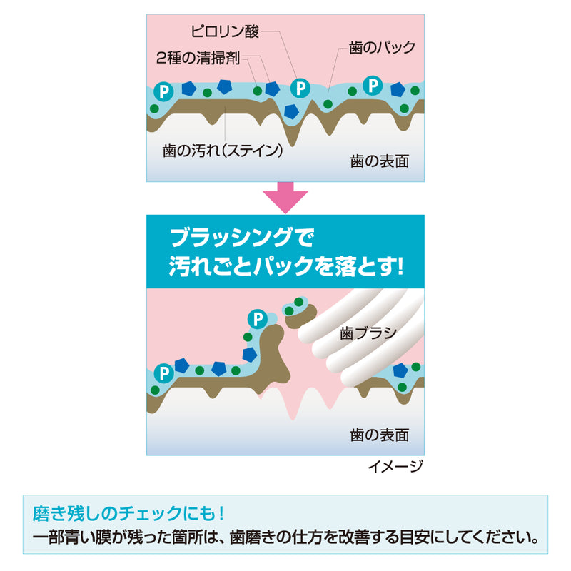 ギャラリービューアに画像をロードする, Shimac シマック クリーンパックHARD（歯膜剤）
