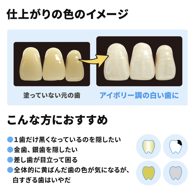 ギャラリービューアに画像をロードする, トゥースヴェール（歯のマニキュア）
